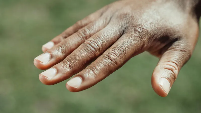 Cracking Your Knuckles Won't Give You Arthritis — A Doctor Spent 60 Years Proving It With His Own Hands